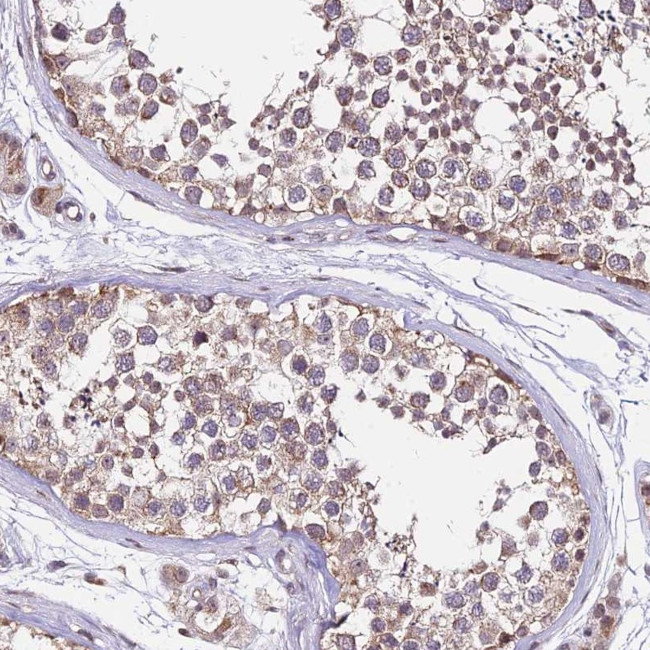C4orf47 Antibody in Immunohistochemistry (Paraffin) (IHC (P))