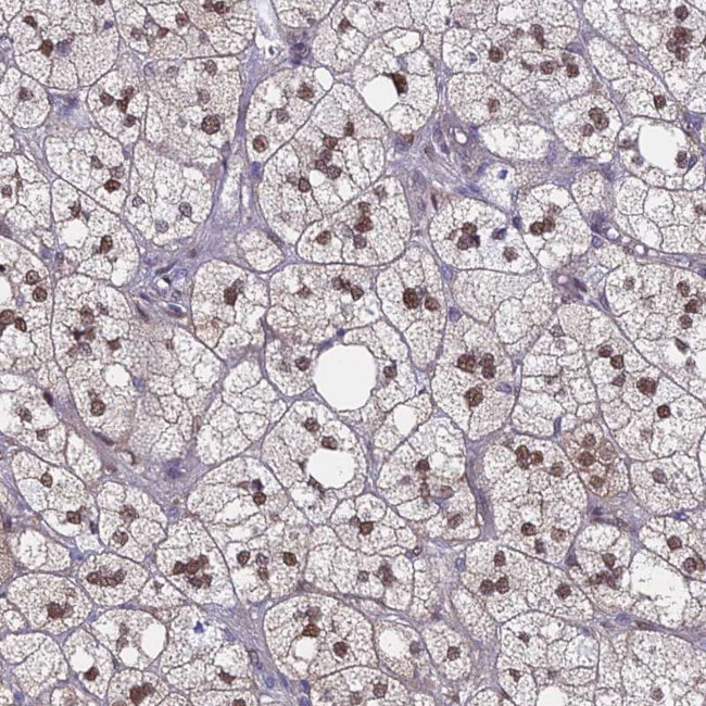 MRPL17 Antibody in Immunohistochemistry (Paraffin) (IHC (P))