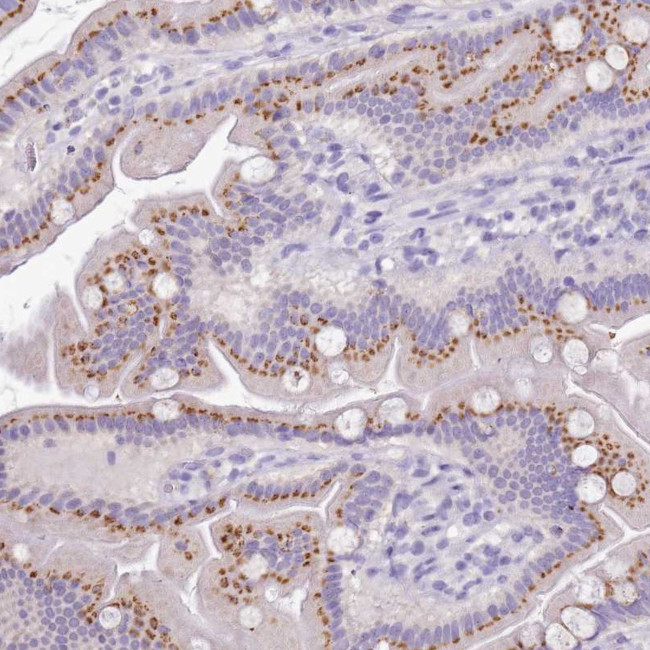 B3GNT8 Antibody in Immunohistochemistry (Paraffin) (IHC (P))