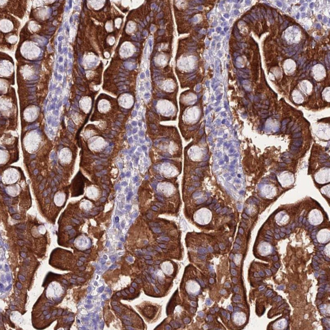 NLRP6 Antibody in Immunohistochemistry (Paraffin) (IHC (P))