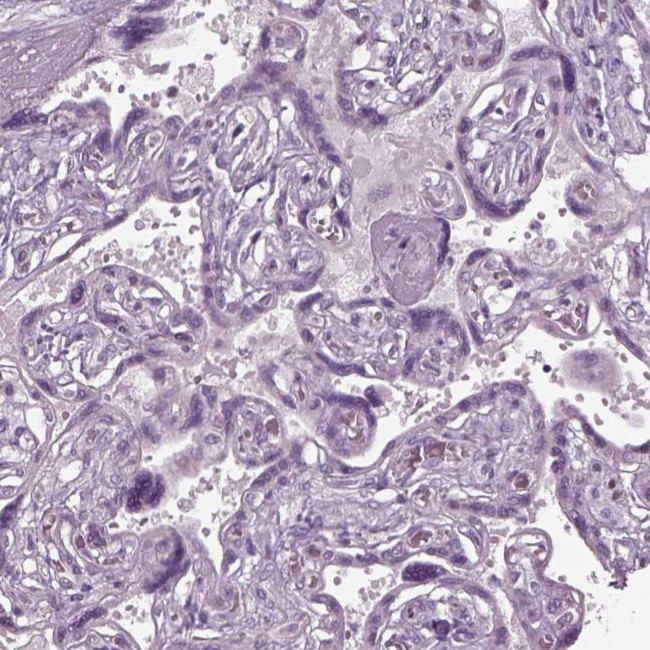 CABP5 Antibody in Immunohistochemistry (Paraffin) (IHC (P))