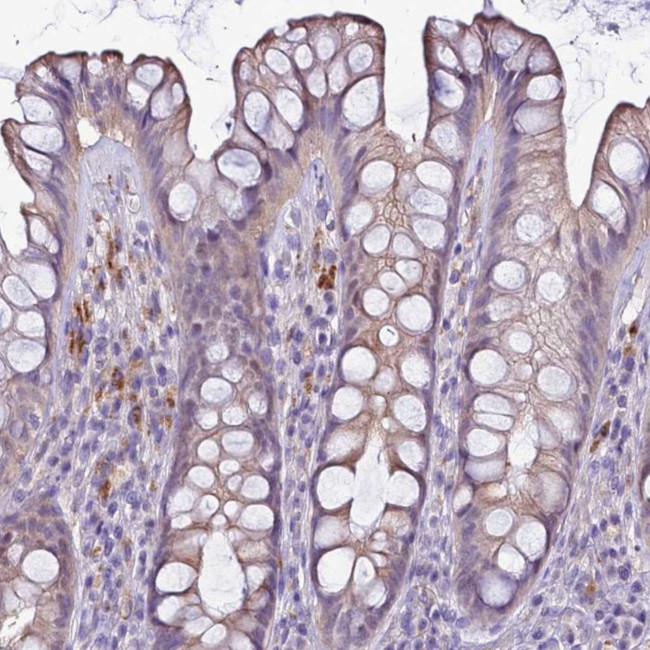NAT1 Antibody in Immunohistochemistry (Paraffin) (IHC (P))