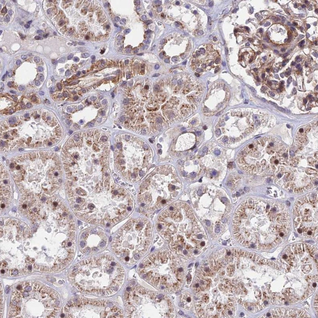 Krt222 Antibody in Immunohistochemistry (Paraffin) (IHC (P))