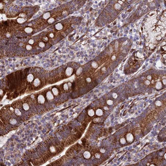 KBTBD7 Antibody in Immunohistochemistry (Paraffin) (IHC (P))