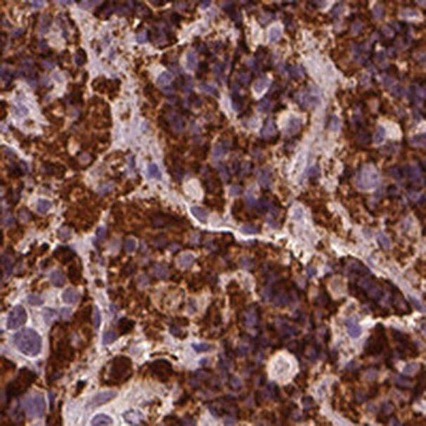 CSH1 Antibody in Immunohistochemistry (IHC)