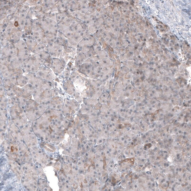 FASTKD1 Antibody in Immunohistochemistry (IHC)