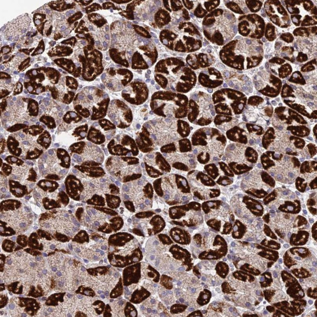 MGAT2 Antibody in Immunohistochemistry (Paraffin) (IHC (P))