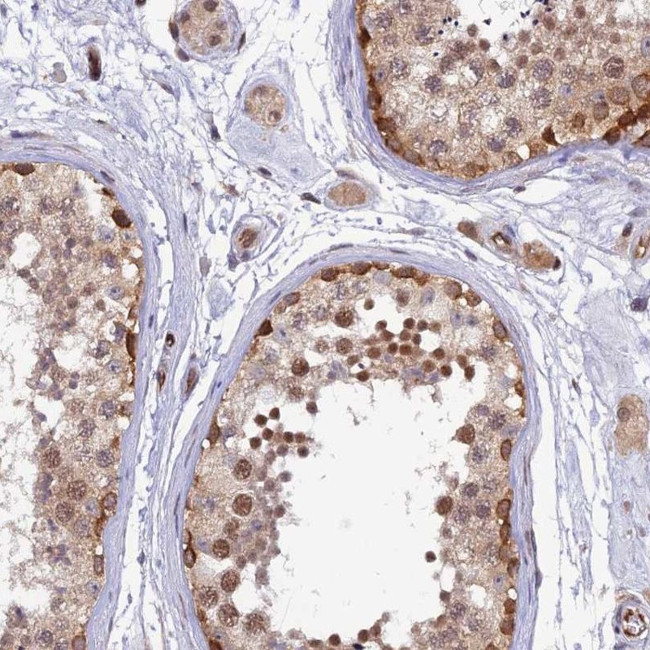 Relaxin 3 Antibody in Immunohistochemistry (IHC)