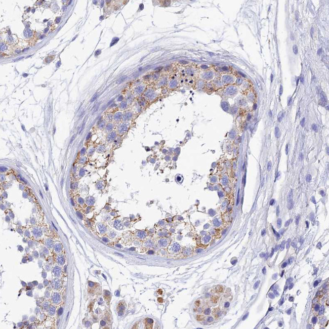 MS4A5 Antibody in Immunohistochemistry (Paraffin) (IHC (P))