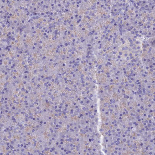 PTPRCAP Antibody in Immunohistochemistry (Paraffin) (IHC (P))