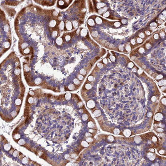 Adiponectin Receptor 2 Antibody in Immunohistochemistry (Paraffin) (IHC (P))