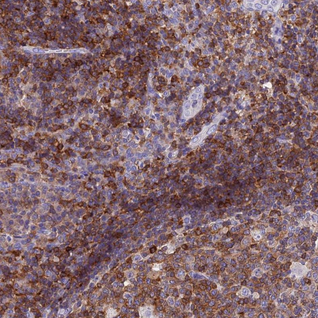 LPXN Antibody in Immunohistochemistry (Paraffin) (IHC (P))