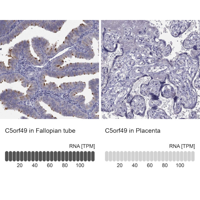 C5orf49 Antibody in Immunohistochemistry (IHC)