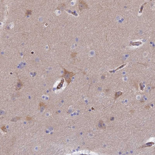 CLVS2 Antibody in Immunohistochemistry (Paraffin) (IHC (P))