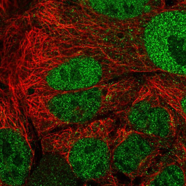 APOA1BP Antibody in Immunocytochemistry (ICC/IF)