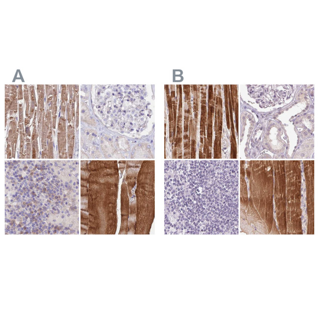 FAM168B Antibody in Immunohistochemistry (IHC)