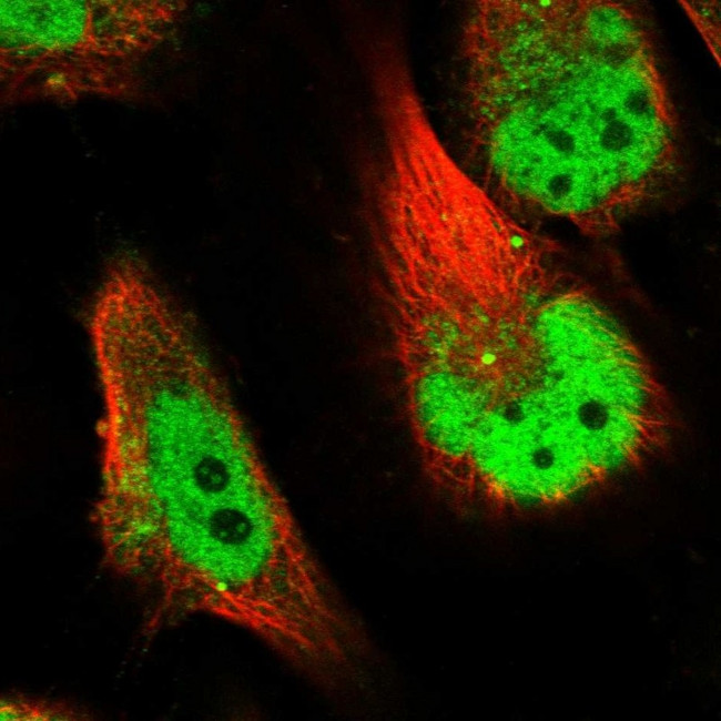 SLC38A9 Antibody in Immunocytochemistry (ICC/IF)