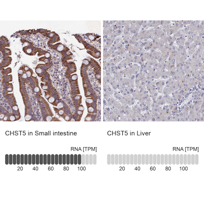 CHST5 Antibody in Immunohistochemistry (IHC)