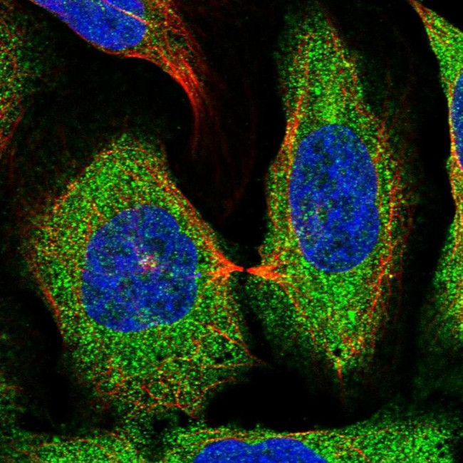 FAM151B Antibody in Immunocytochemistry (ICC/IF)