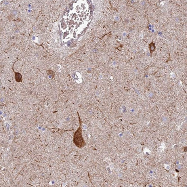 RHBDL2 Antibody in Immunohistochemistry (IHC)