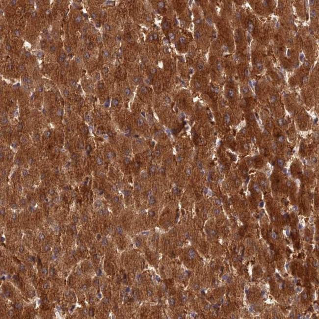 ISPD Antibody in Immunohistochemistry (Paraffin) (IHC (P))