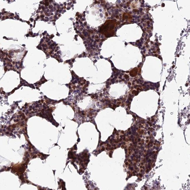 CCDC183 Antibody in Immunohistochemistry (Paraffin) (IHC (P))