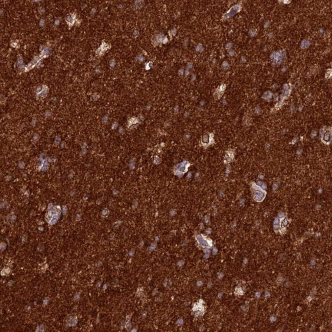 ST8SIA5 Antibody in Immunohistochemistry (IHC)