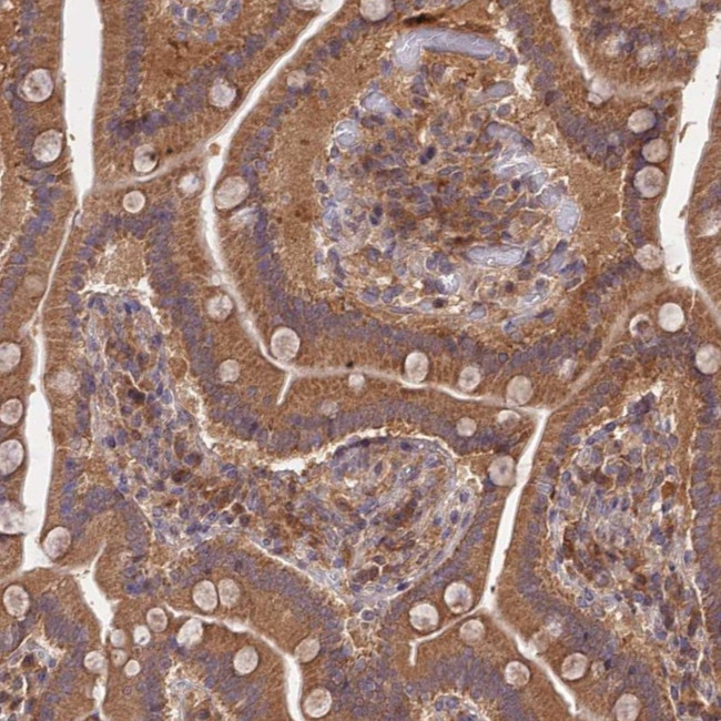 TRIM40 Antibody in Immunohistochemistry (Paraffin) (IHC (P))