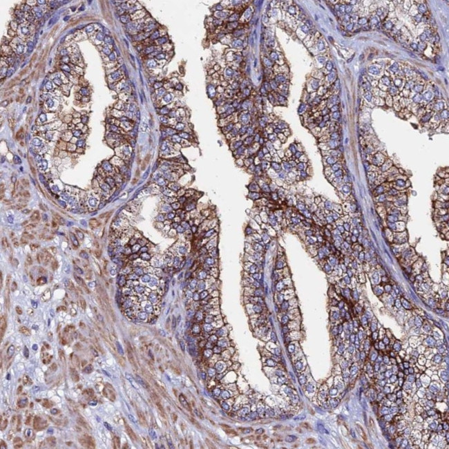 Complement C6 Antibody in Immunohistochemistry (Paraffin) (IHC (P))