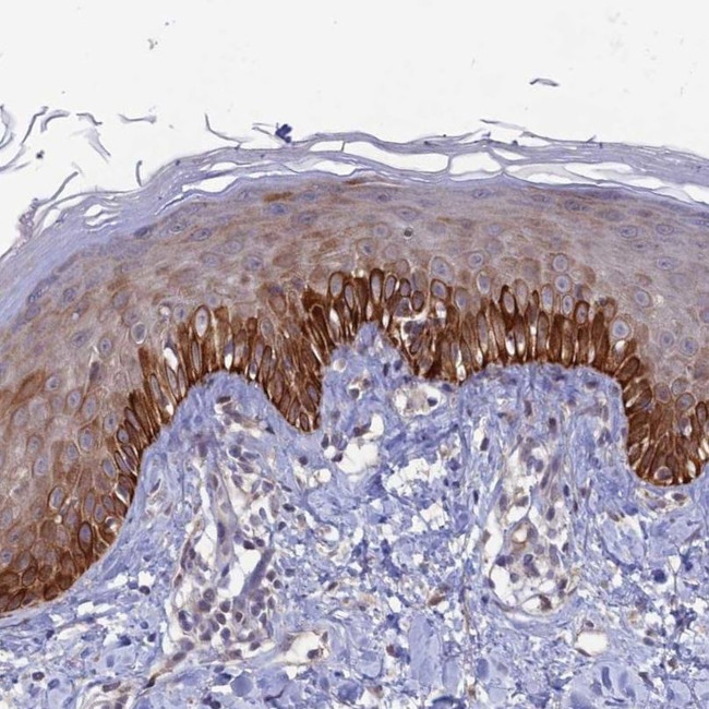 FASTKD5 Antibody in Immunohistochemistry (IHC)