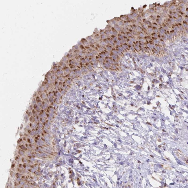 IEX-1 Antibody in Immunohistochemistry (Paraffin) (IHC (P))