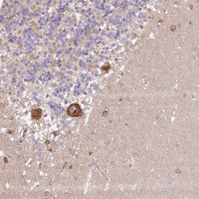PPME1 Antibody in Immunohistochemistry (Paraffin) (IHC (P))