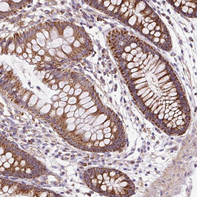CEP290 Antibody in Immunohistochemistry (Paraffin) (IHC (P))