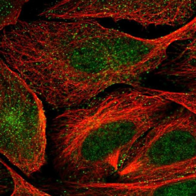 VWCE Antibody in Immunocytochemistry (ICC/IF)