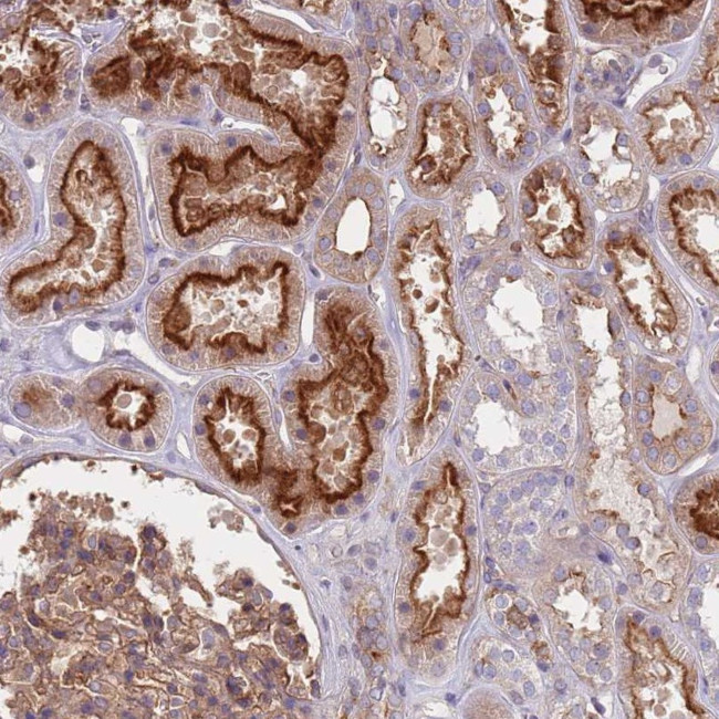 DIP13B Antibody in Immunohistochemistry (Paraffin) (IHC (P))