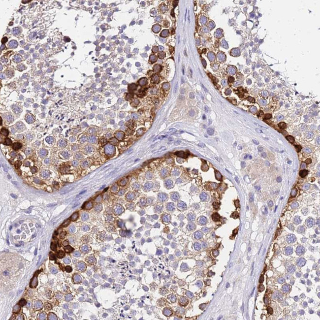 HERC5 Antibody in Immunohistochemistry (Paraffin) (IHC (P))