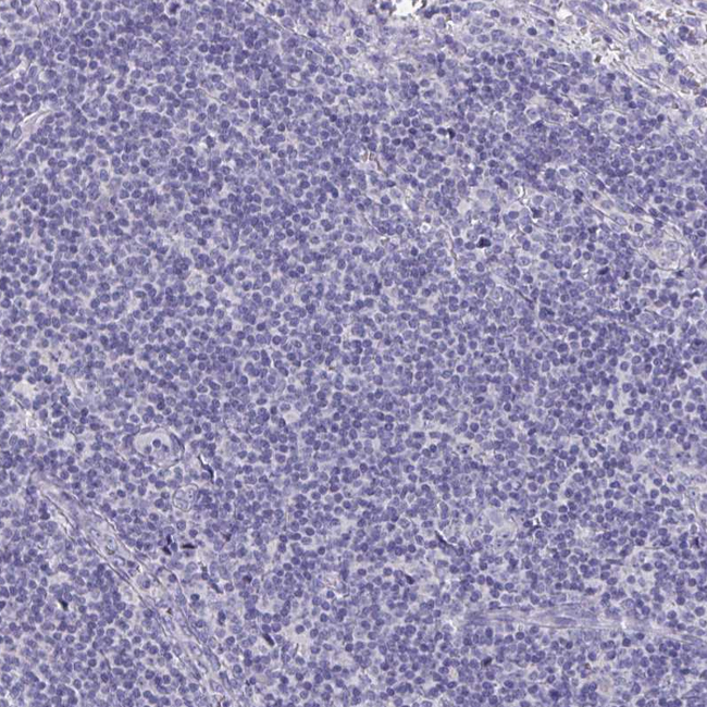 SCP3 Antibody in Immunohistochemistry (Paraffin) (IHC (P))
