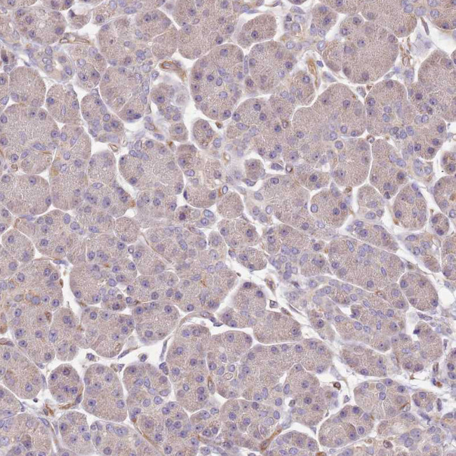 DOCK9 Antibody in Immunohistochemistry (Paraffin) (IHC (P))