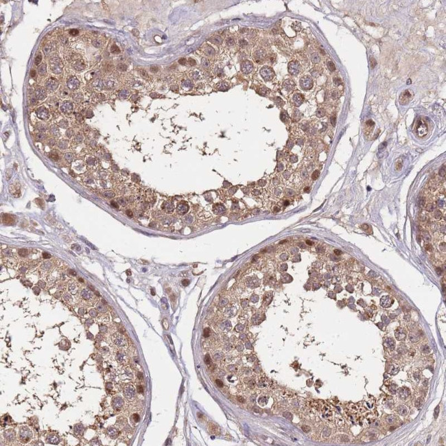 CDKN2AIPNL Antibody in Immunohistochemistry (Paraffin) (IHC (P))