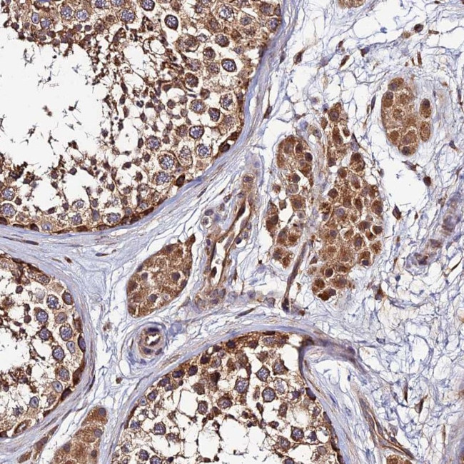 CCDC150 Antibody in Immunohistochemistry (Paraffin) (IHC (P))