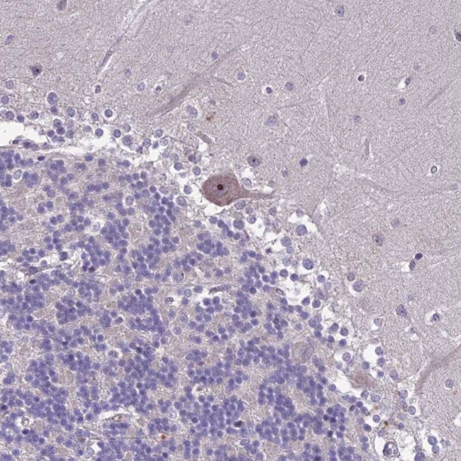 ZNF333 Antibody in Immunohistochemistry (IHC)