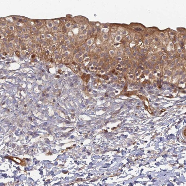 INO80D Antibody in Immunohistochemistry (IHC)