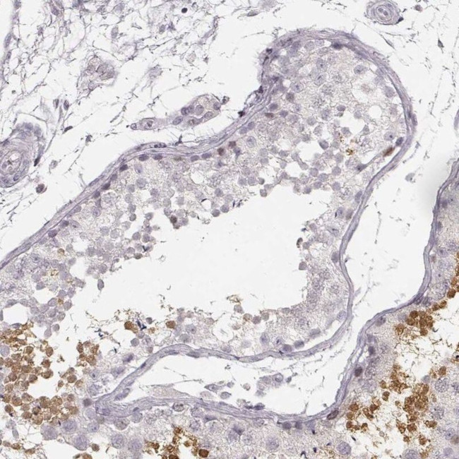 TEX37 Antibody in Immunohistochemistry (IHC)