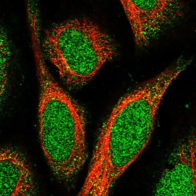 SPATA24 Antibody in Immunocytochemistry (ICC/IF)