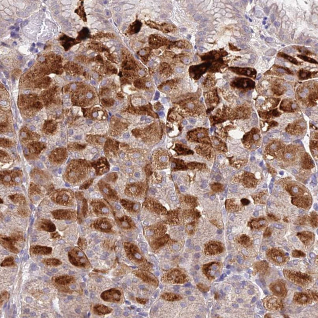 CP013 Antibody in Immunohistochemistry (Paraffin) (IHC (P))