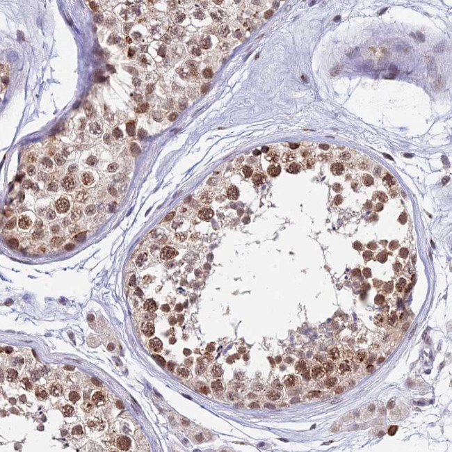 THOC3 Antibody in Immunohistochemistry (Paraffin) (IHC (P))