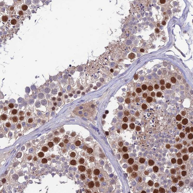C19orf57 Antibody in Immunohistochemistry (Paraffin) (IHC (P))