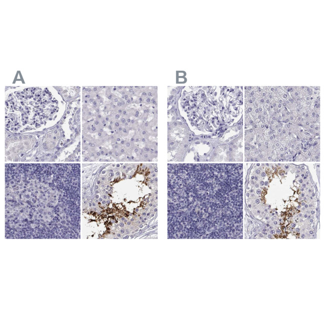 CLPH Antibody in Immunohistochemistry (IHC)