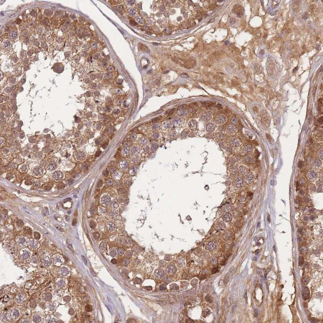 FAM153A Antibody in Immunohistochemistry (Paraffin) (IHC (P))