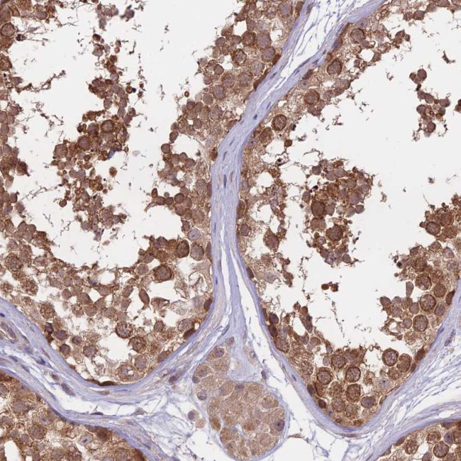 FABP12 Antibody in Immunohistochemistry (Paraffin) (IHC (P))